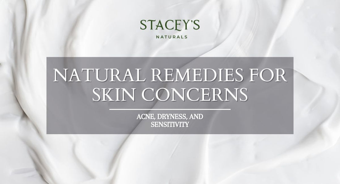 Natural Remedies for Common Skin Concerns: Acne, Dryness, and Sensitivity