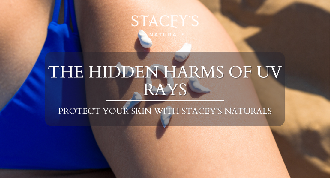 The Hidden Harms of UV Rays: Protect Your Skin with Stacey’s Naturals