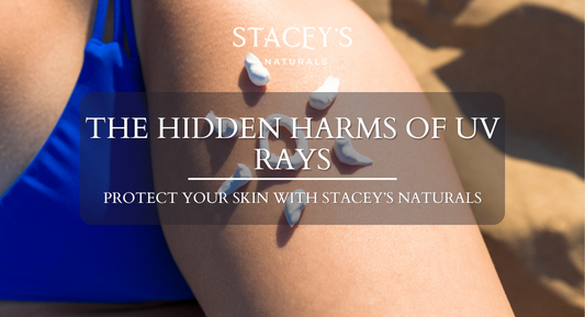 The Hidden Harms of UV Rays: Protect Your Skin with Stacey’s Naturals