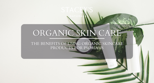 The Benefits of Using Organic Skincare Products for Psoriasis