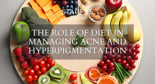 The Role of Diet in Managing Acne and Hyperpigmentation