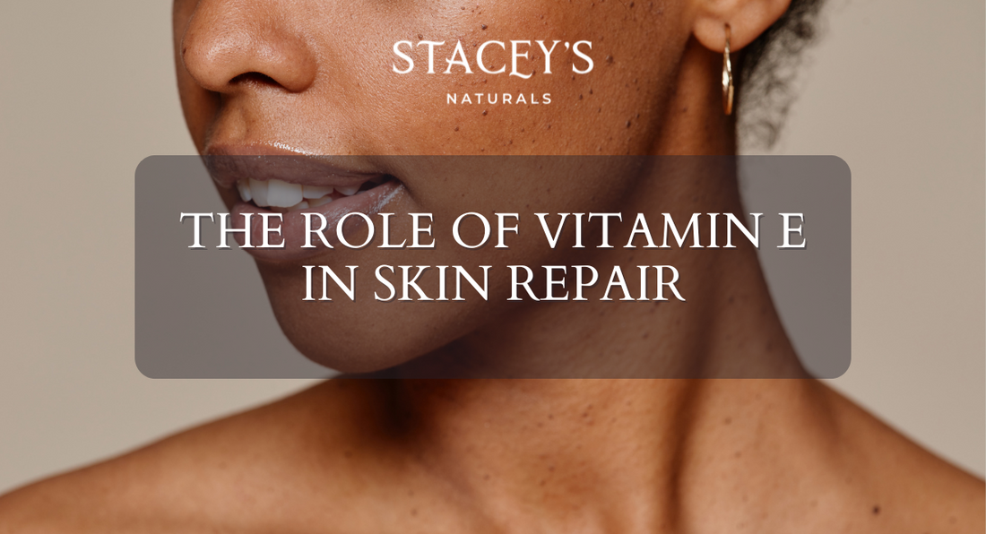 The Role of Vitamin E in Skin Repair